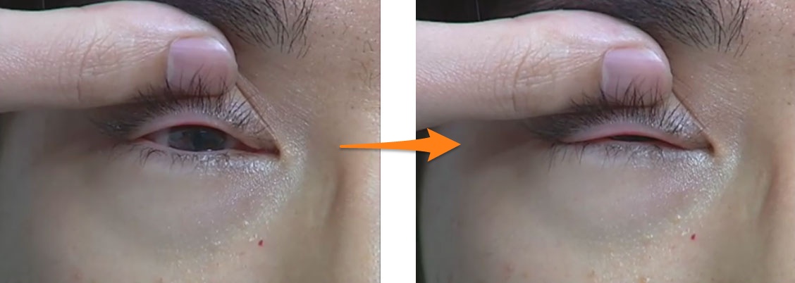 eye1-1