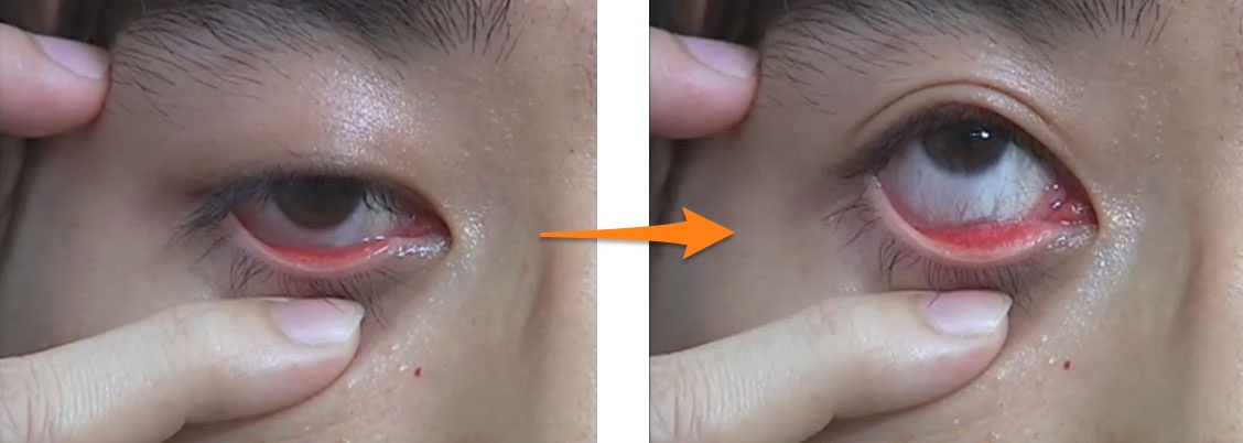 eye2-2